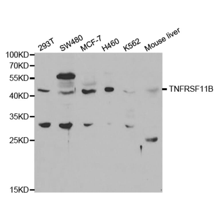 Western blot - TNFRSF11B Antibody from Signalway Antibody (32597) - Antibodies.com