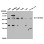 Western blot - TNFRSF11B Antibody from Signalway Antibody (32597) - Antibodies.com