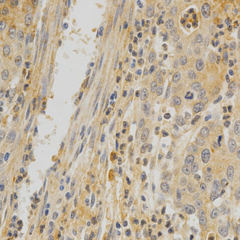 Immunohistochemistry - TNFRSF11B Antibody from Signalway Antibody (32597) - Antibodies.com