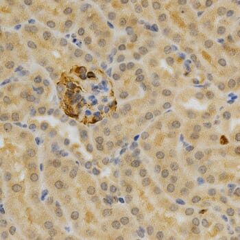 Immunohistochemistry of paraffin-embedded mouse kidney using TNFRSF11B antibody at dilution of 1: 200 (x400 lens)