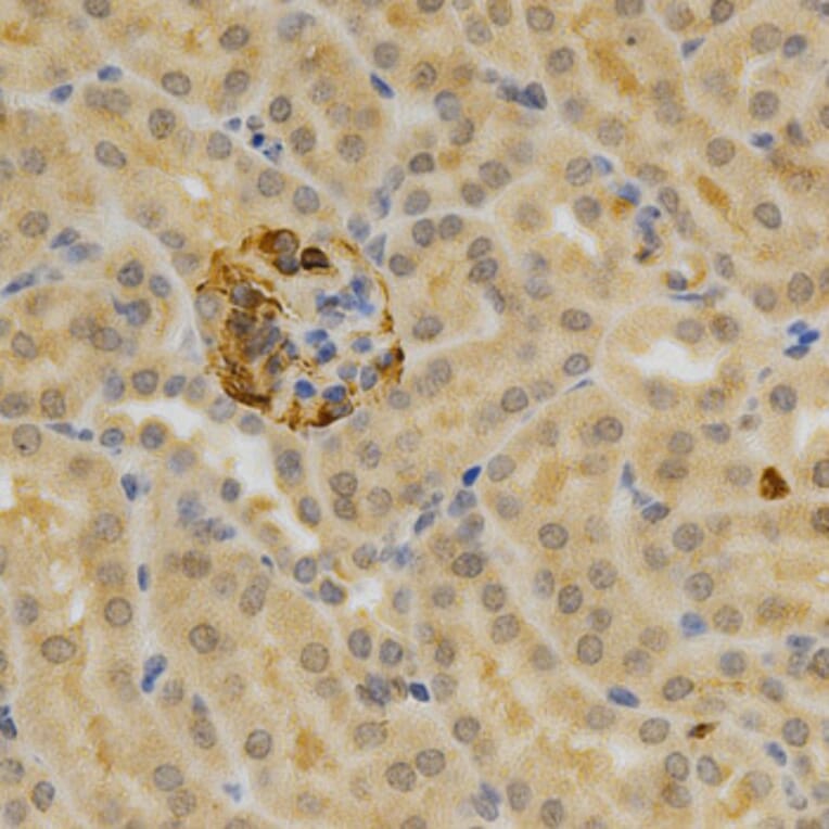 Immunohistochemistry - TNFRSF11B Antibody from Signalway Antibody (32597) - Antibodies.com