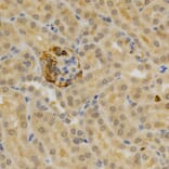 Immunohistochemistry - TNFRSF11B Antibody from Signalway Antibody (32597) - Antibodies.com