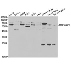 Western blot - MAP3K7IP1 Antibody from Signalway Antibody (33014) - Antibodies.com