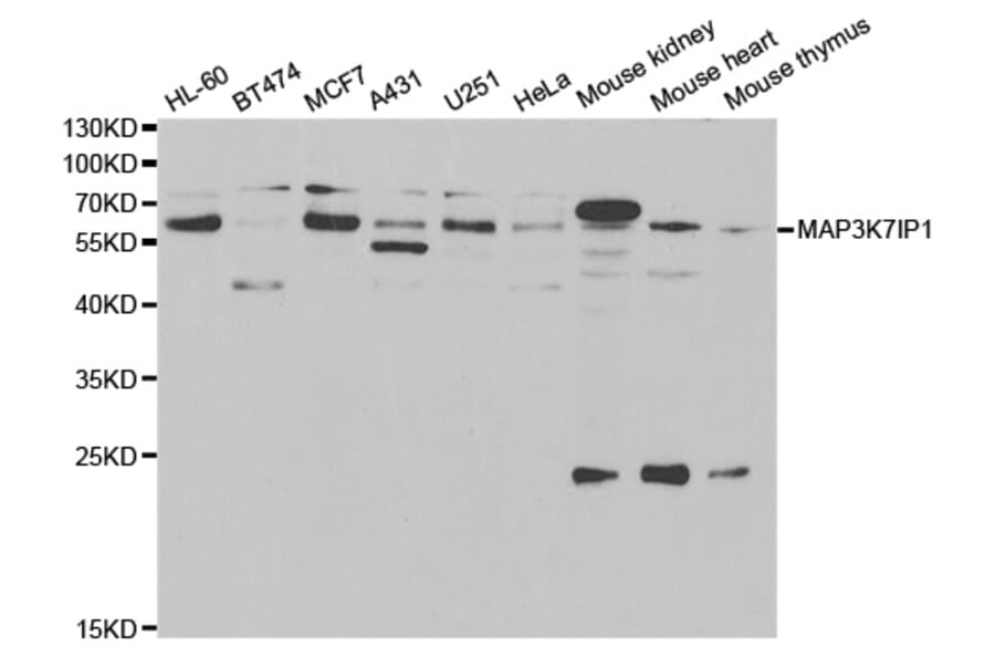 Western blot - MAP3K7IP1 Antibody from Signalway Antibody (33014) - Antibodies.com