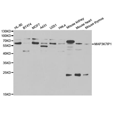 Western blot - MAP3K7IP1 Antibody from Signalway Antibody (33014) - Antibodies.com