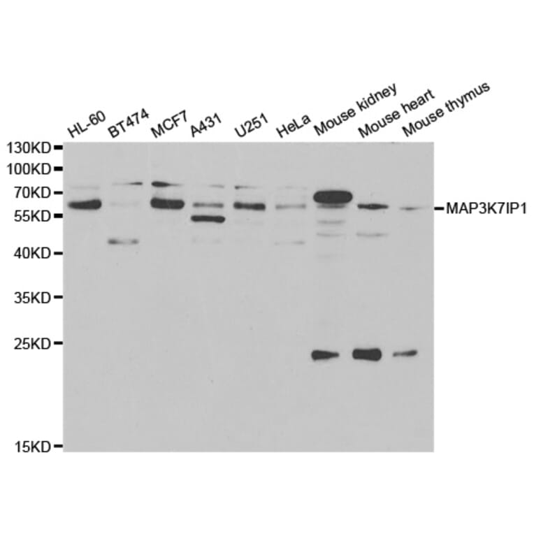 Western blot - MAP3K7IP1 Antibody from Signalway Antibody (33014) - Antibodies.com