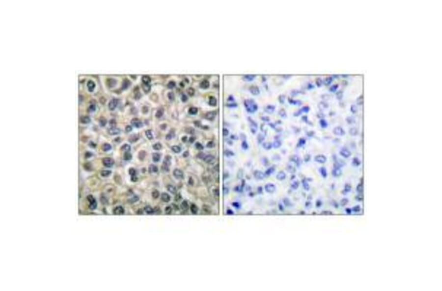 Immunohistochemistry - Catenin-γ Antibody from Signalway Antibody (33330) - Antibodies.com