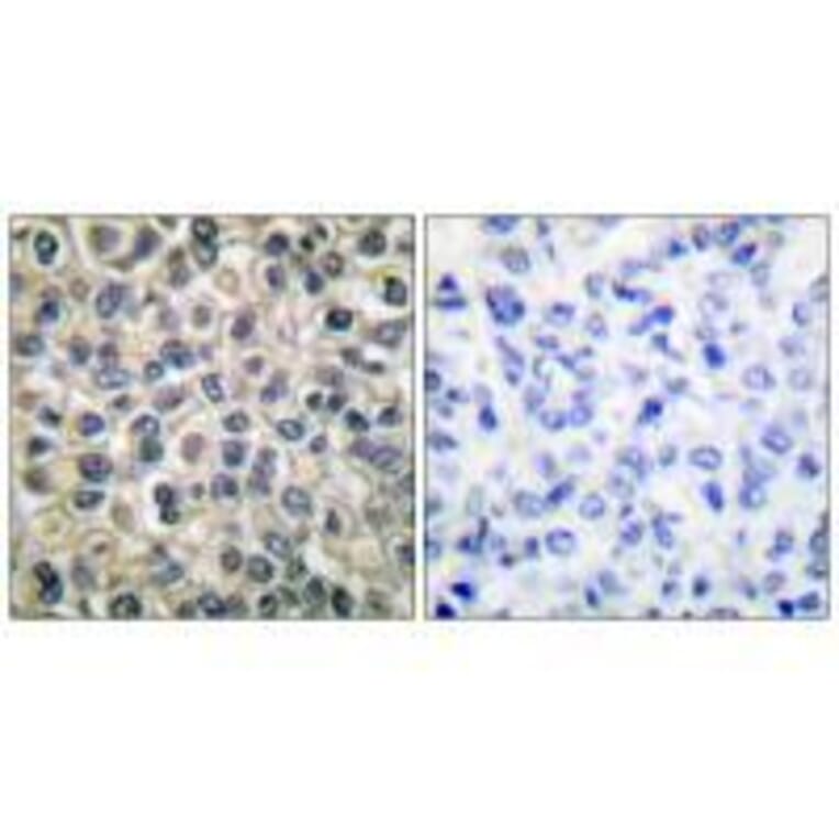 Immunohistochemistry - Catenin-γ Antibody from Signalway Antibody (33330) - Antibodies.com