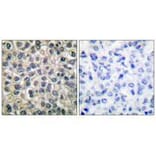 Immunohistochemistry - Catenin-γ Antibody from Signalway Antibody (33330) - Antibodies.com