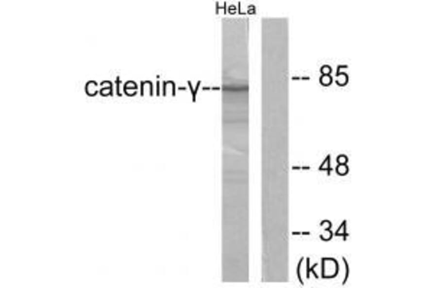 Western blot - Catenin-γ Antibody from Signalway Antibody (33330) - Antibodies.com