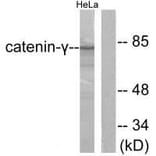 Western blot - Catenin-γ Antibody from Signalway Antibody (33330) - Antibodies.com