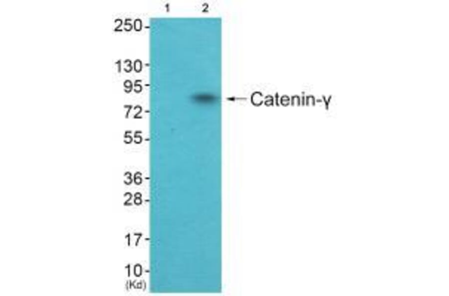 Western blot - Catenin-γ Antibody from Signalway Antibody (33330) - Antibodies.com