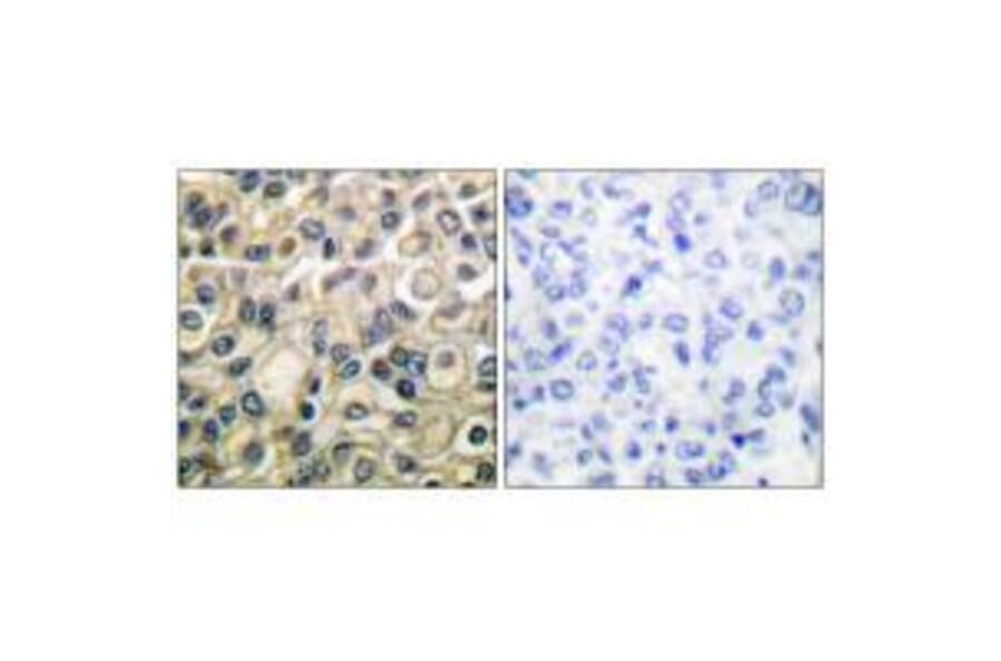 Immunohistochemistry - Claudin 1 Antibody from Signalway Antibody (33332) - Antibodies.com