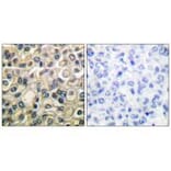 Immunohistochemistry - Claudin 1 Antibody from Signalway Antibody (33332) - Antibodies.com
