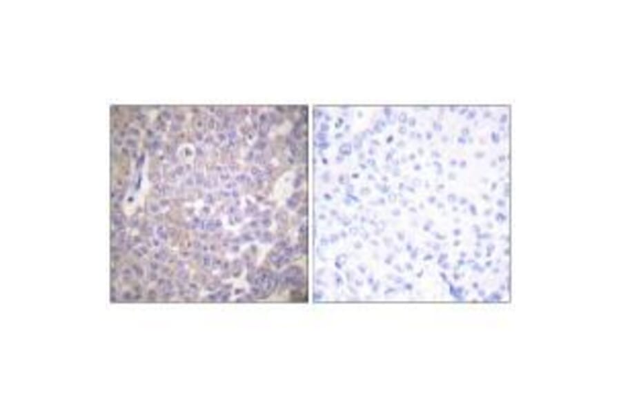 Immunohistochemistry - Claudin 2 Antibody from Signalway Antibody (33333) - Antibodies.com
