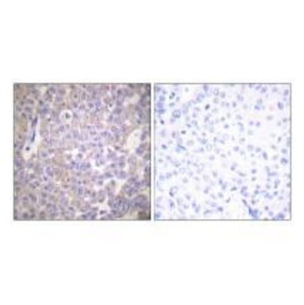 Immunohistochemistry - Claudin 2 Antibody from Signalway Antibody (33333) - Antibodies.com