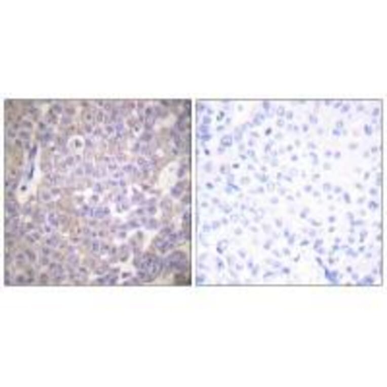Immunohistochemistry - Claudin 2 Antibody from Signalway Antibody (33333) - Antibodies.com