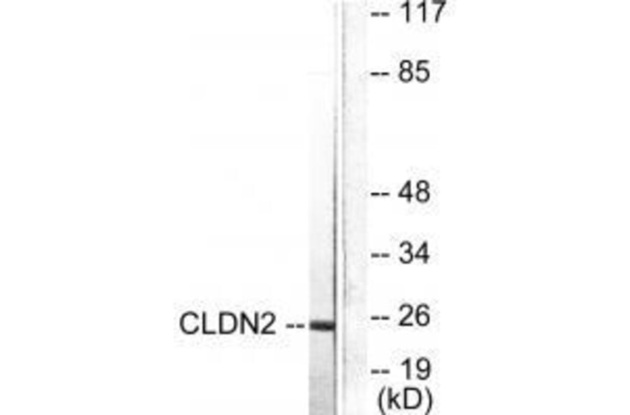 Western blot - Claudin 2 Antibody from Signalway Antibody (33333) - Antibodies.com