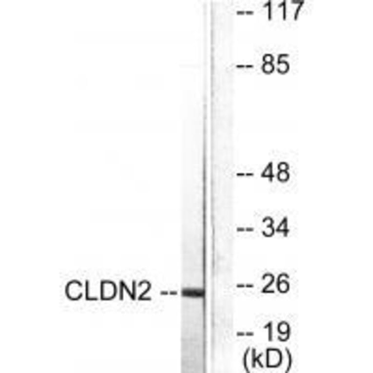 Western blot - Claudin 2 Antibody from Signalway Antibody (33333) - Antibodies.com