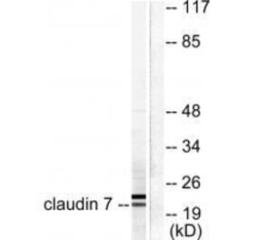 Western blot - Claudin 7 Antibody from Signalway Antibody (33339) - Antibodies.com