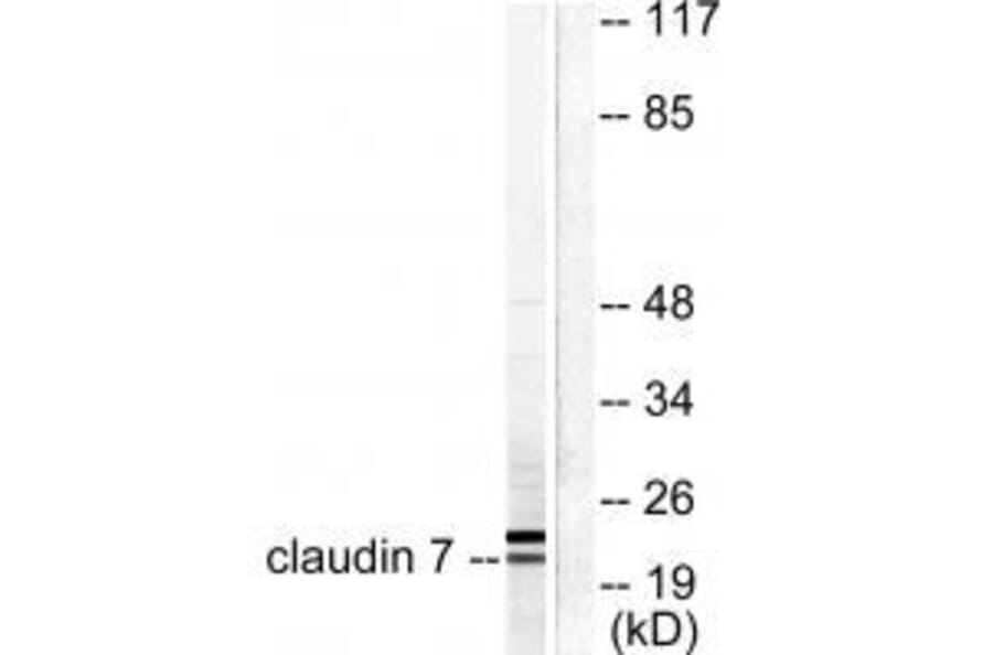 Western blot - Claudin 7 Antibody from Signalway Antibody (33339) - Antibodies.com