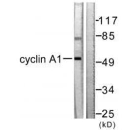 Western blot - Cyclin A1 Antibody from Signalway Antibody (33350) - Antibodies.com