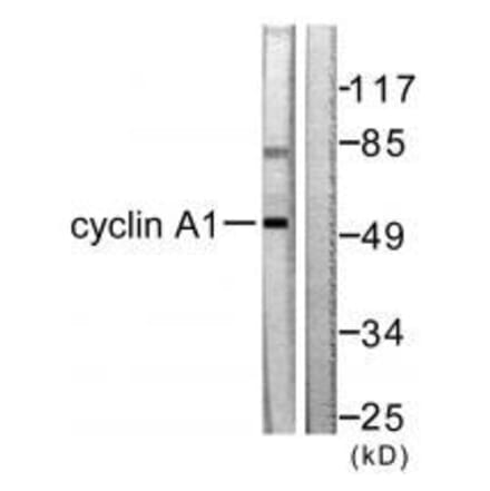 Western blot - Cyclin A1 Antibody from Signalway Antibody (33350) - Antibodies.com