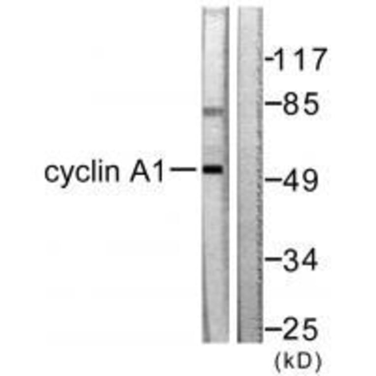 Western blot - Cyclin A1 Antibody from Signalway Antibody (33350) - Antibodies.com