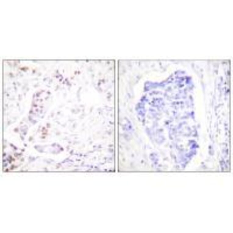 Immunohistochemistry - Cyclin A1 Antibody from Signalway Antibody (33350) - Antibodies.com