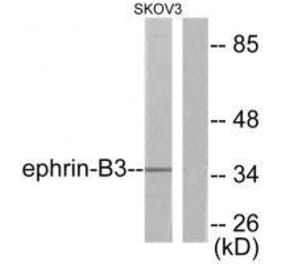 Western blot - Ephrin-B3 Antibody from Signalway Antibody (33364) - Antibodies.com