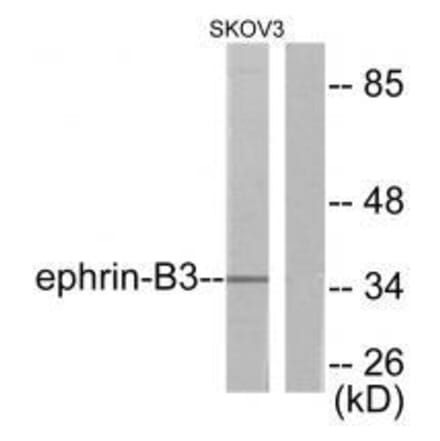 Western blot - Ephrin-B3 Antibody from Signalway Antibody (33364) - Antibodies.com