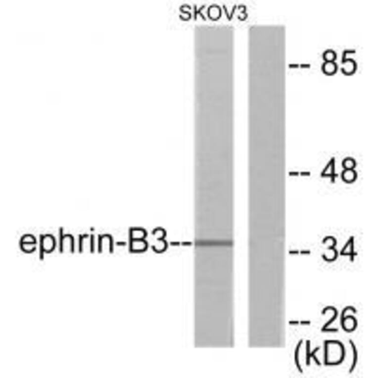 Western blot - Ephrin-B3 Antibody from Signalway Antibody (33364) - Antibodies.com