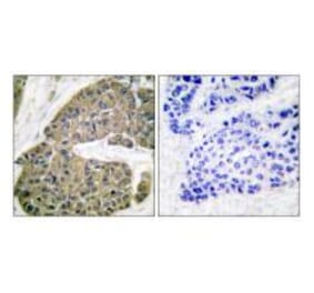Immunohistochemistry - Keratin 5 Antibody from Signalway Antibody (33419) - Antibodies.com