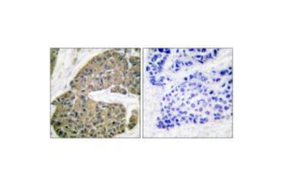 Immunohistochemistry - Keratin 5 Antibody from Signalway Antibody (33419) - Antibodies.com