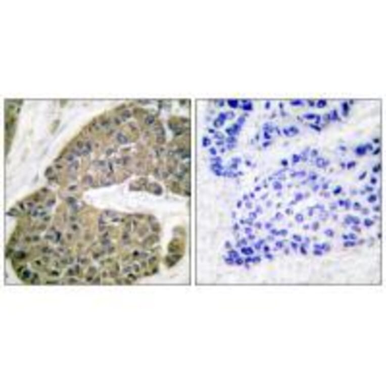 Immunohistochemistry - Keratin 5 Antibody from Signalway Antibody (33419) - Antibodies.com