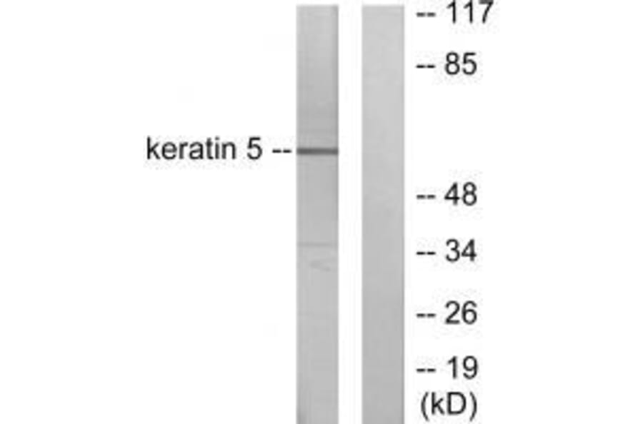 Western blot - Keratin 5 Antibody from Signalway Antibody (33419) - Antibodies.com