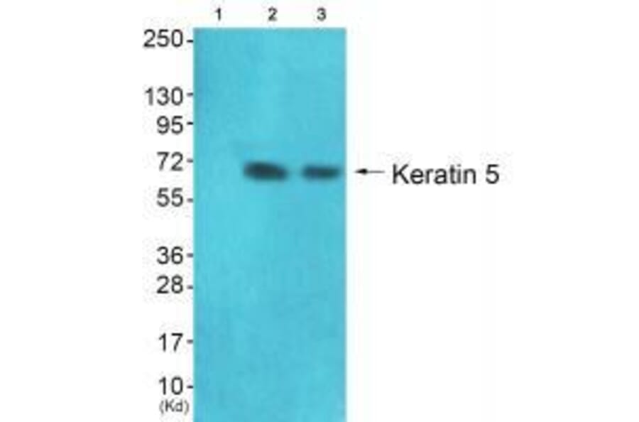 Western blot - Keratin 5 Antibody from Signalway Antibody (33419) - Antibodies.com