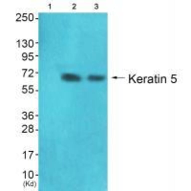 Western blot - Keratin 5 Antibody from Signalway Antibody (33419) - Antibodies.com