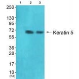 Western blot - Keratin 5 Antibody from Signalway Antibody (33419) - Antibodies.com