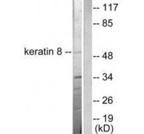 Western blot - Keratin 8 Antibody from Signalway Antibody (33421) - Antibodies.com