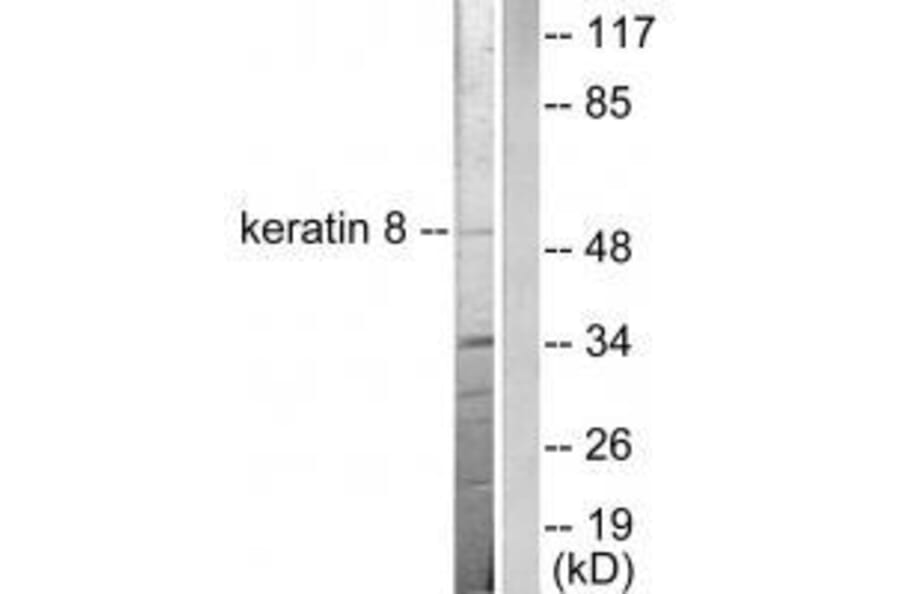 Western blot - Keratin 8 Antibody from Signalway Antibody (33421) - Antibodies.com