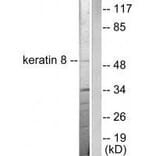 Western blot - Keratin 8 Antibody from Signalway Antibody (33421) - Antibodies.com