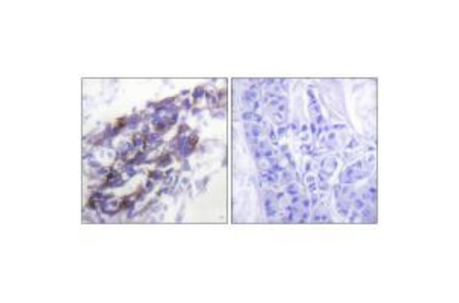 Immunohistochemistry - Keratin 8 Antibody from Signalway Antibody (33421) - Antibodies.com