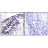 Immunohistochemistry - Keratin 8 Antibody from Signalway Antibody (33421) - Antibodies.com