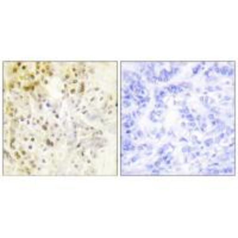 Immunohistochemistry - Cyclin-L1 Antibody from Signalway Antibody (33465) - Antibodies.com