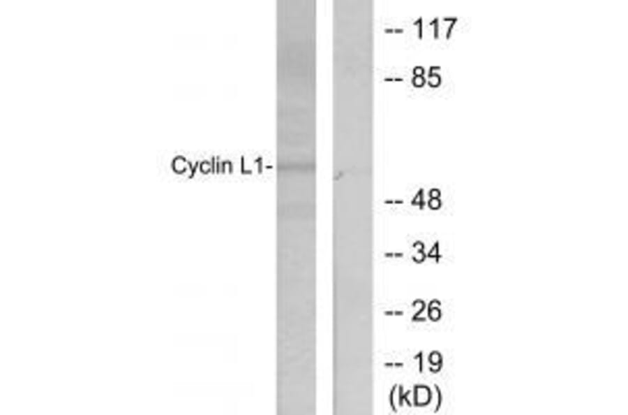 Western blot - Cyclin-L1 Antibody from Signalway Antibody (33465) - Antibodies.com