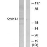 Western blot - Cyclin-L1 Antibody from Signalway Antibody (33465) - Antibodies.com