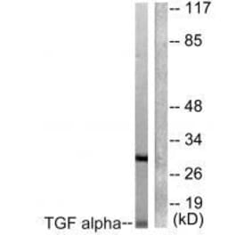 Western blot - TGF alpha Antibody from Signalway Antibody (33499) - Antibodies.com