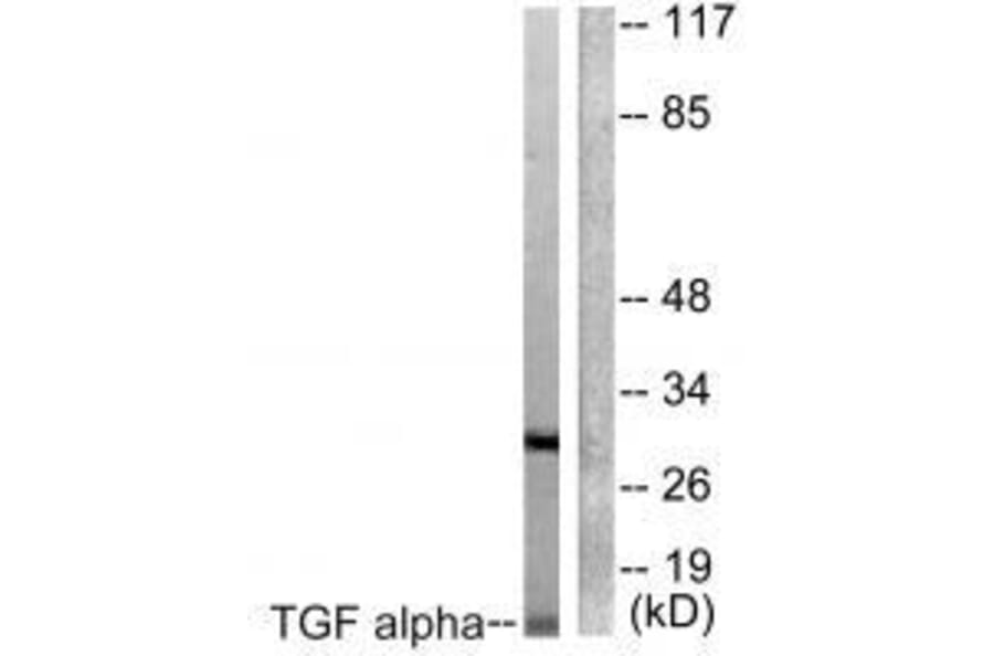Western blot - TGF alpha Antibody from Signalway Antibody (33499) - Antibodies.com