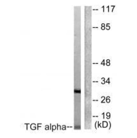 Western blot - TGF alpha Antibody from Signalway Antibody (33499) - Antibodies.com